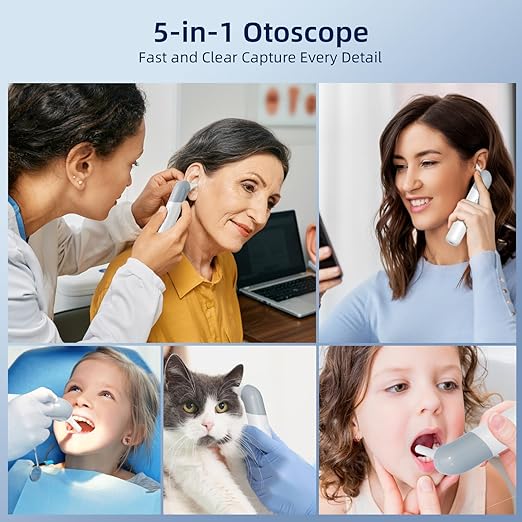 Qimic Wireless Otoscope Ear Camera - 1080P WiFi Otoscope with 6 LED Lights, Ear Scope Camera with 10 Colorful Accessories for Kids,Pets &Adults,Support Photo and Video, Compatible with Android