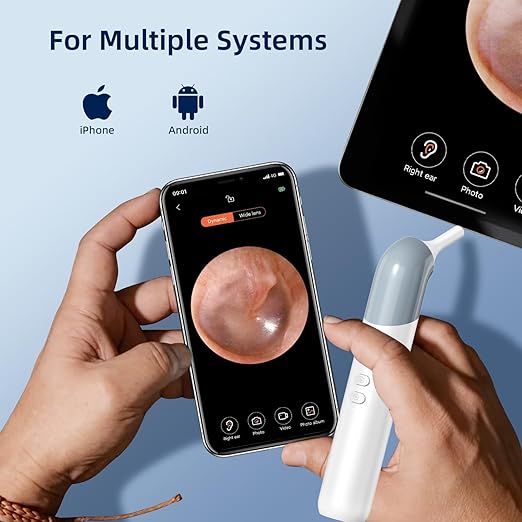 Qimic Wireless Otoscope Ear Camera - 1080P WiFi Otoscope with 6 LED Lights, Ear Scope Camera with 10 Colorful Accessories for Kids,Pets &Adults,Support Photo and Video, Compatible with Android